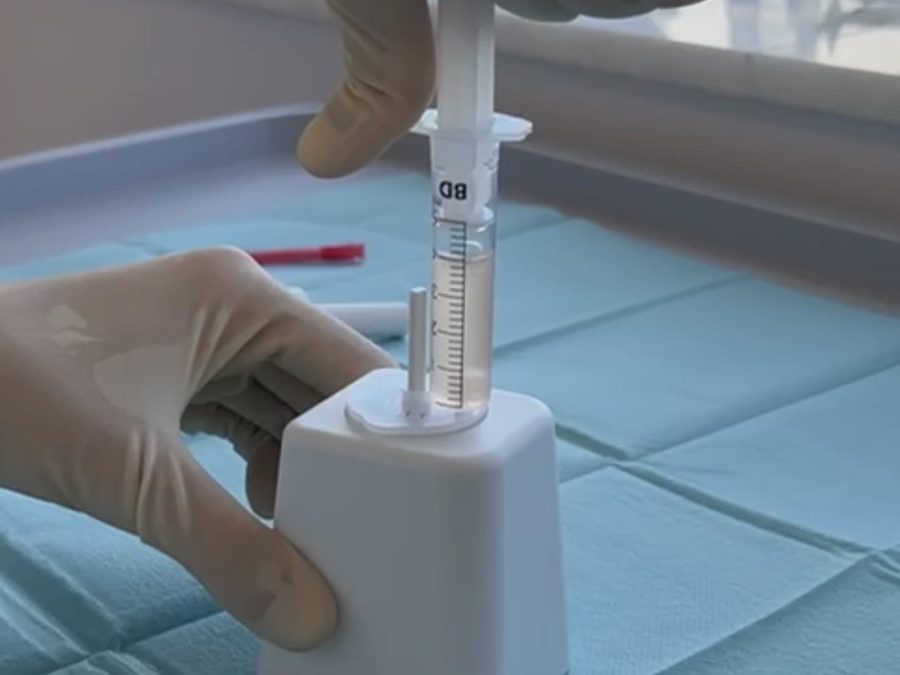 Preparación de un tratamiento biológico en consulta